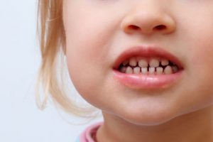 Odontopediatria-clinica-dental-Infantil-clinica-dental-infantil
